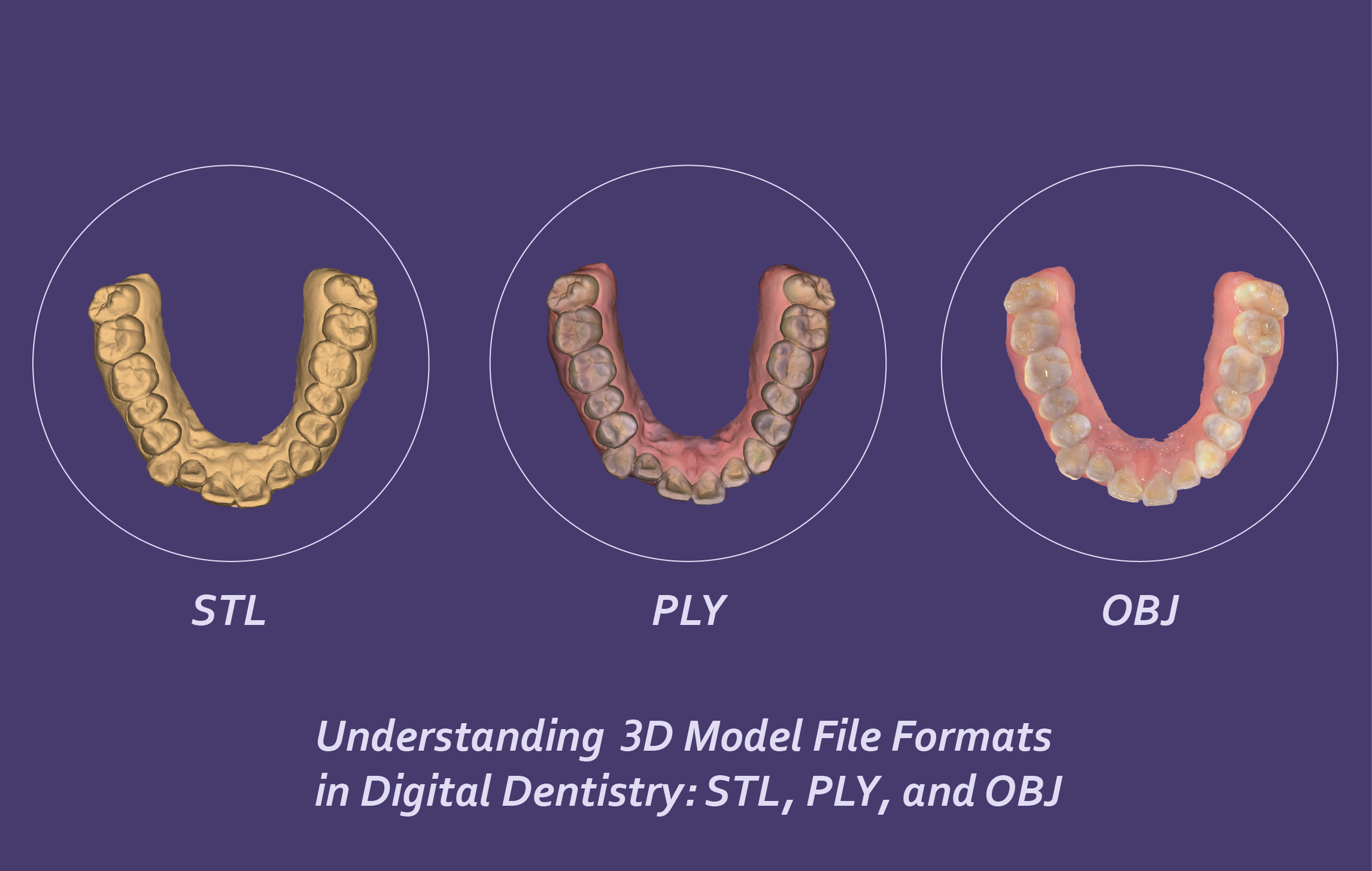Understanding 3D Model File Formats in Digital Dentistry: STL vs PLY vs OBJ