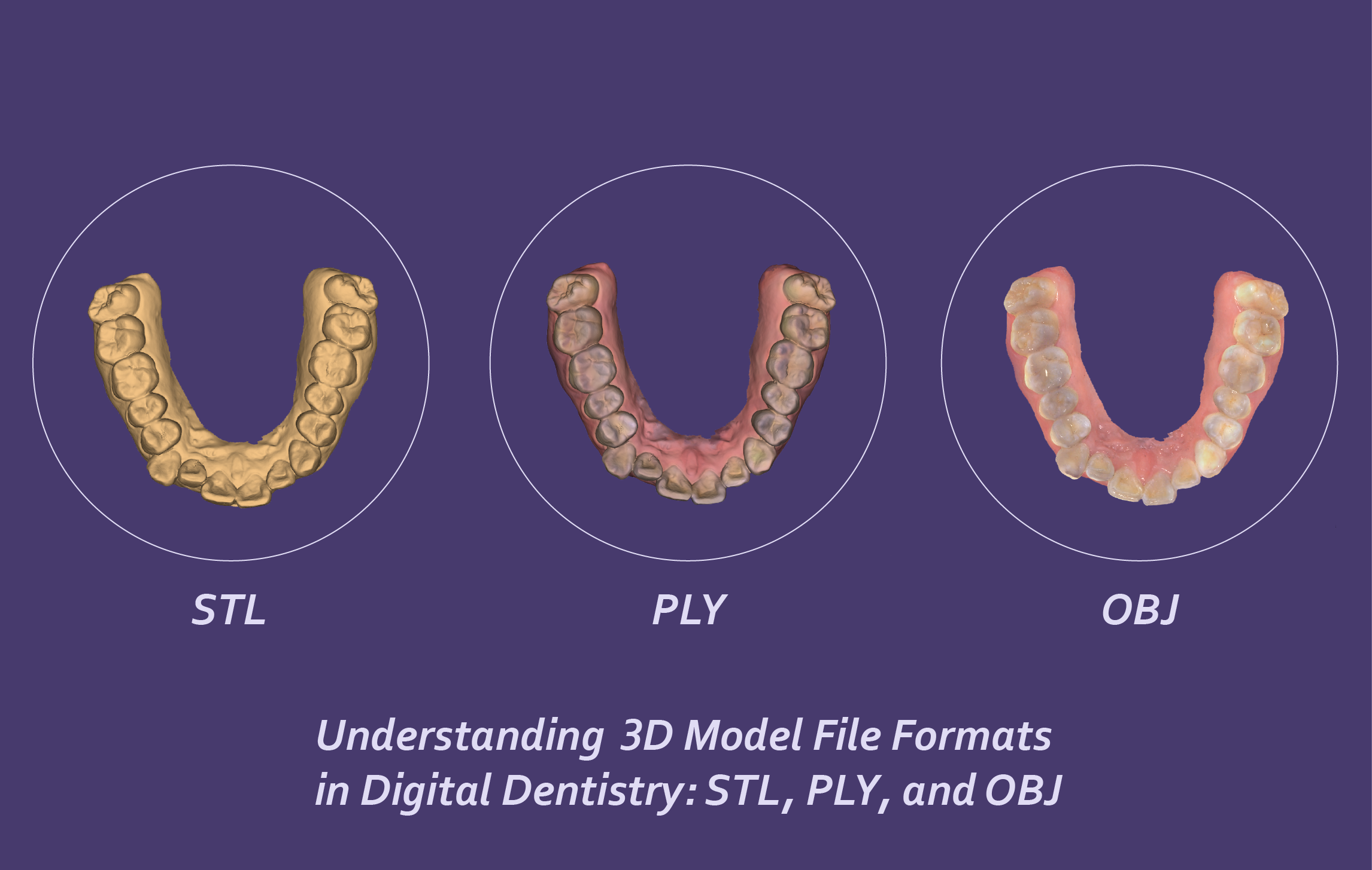 ทำความเข้าใจกับรูปแบบไฟล์โมเดล 3 มิติในทางทันตกรรมดิจิทัล: STL กับ PLY และ OBJ