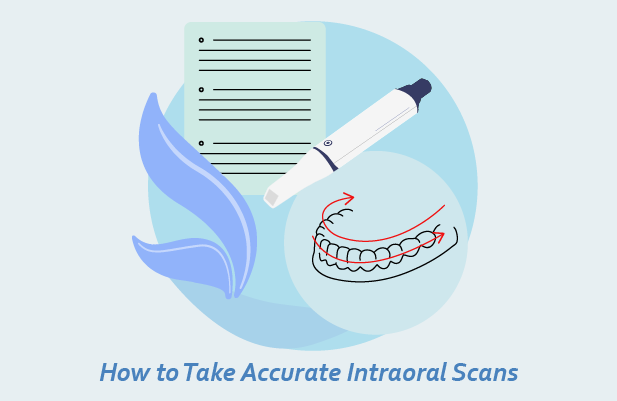 Mastering Intraoral Scanning: Tips for Accurate Digital Impressions