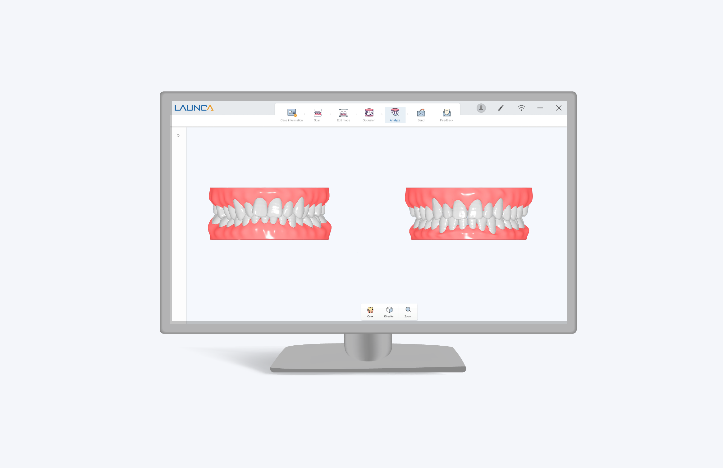 Ortho Simulation