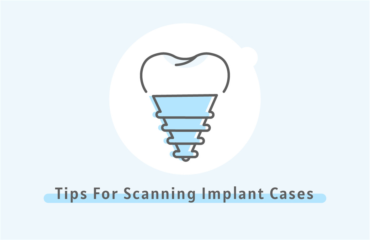 Tips on Scanning Implant Cases