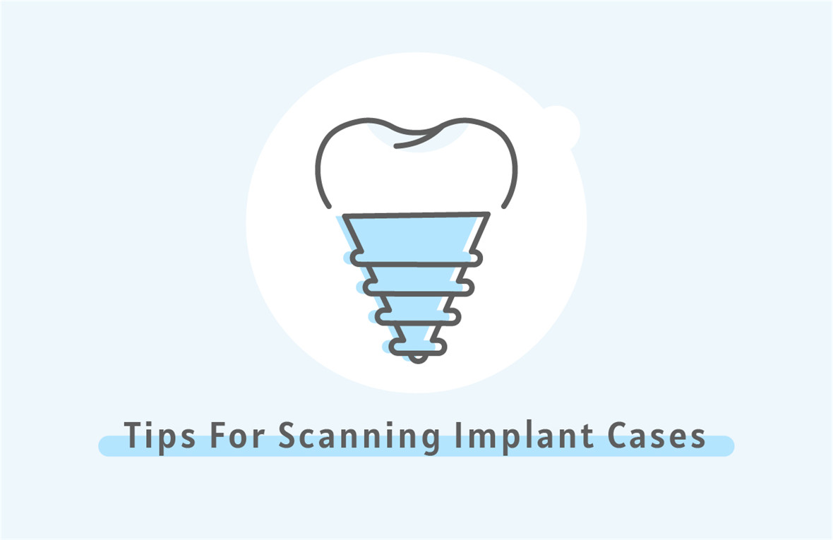 Cunsiglii per scanning cases implants-01_2