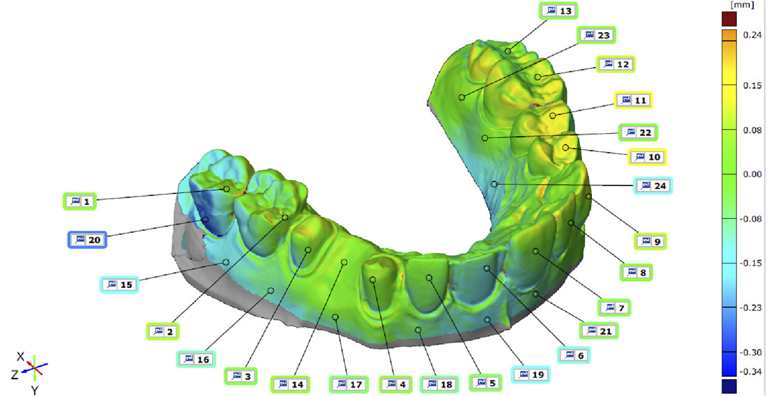 Quid est intraoral Scanner et quomodo operatur