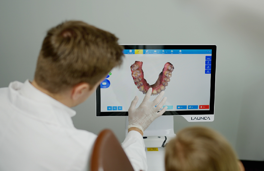 high accuracy image of launca dl206 intraoral scanner