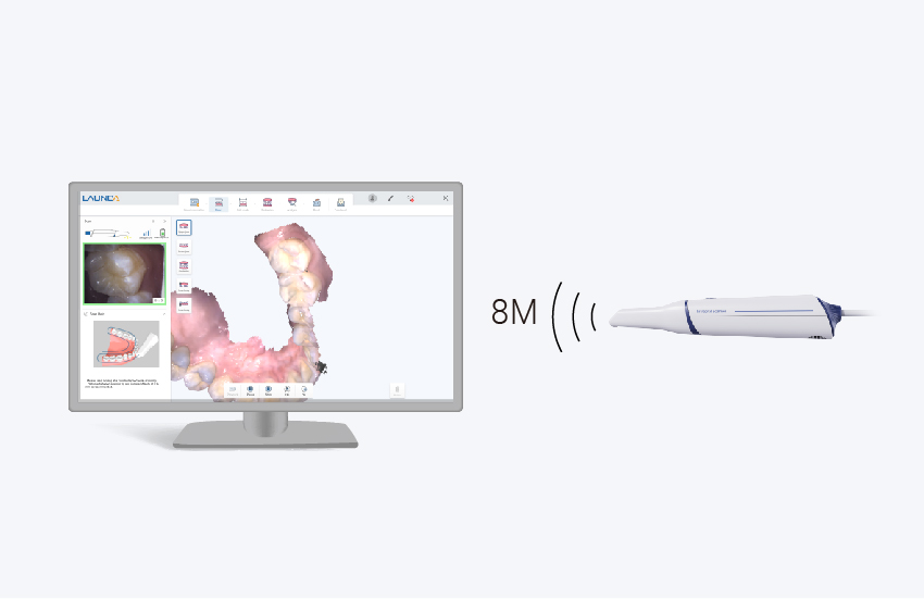 launca dl300 wireless intraoral scanner 8m wireless range