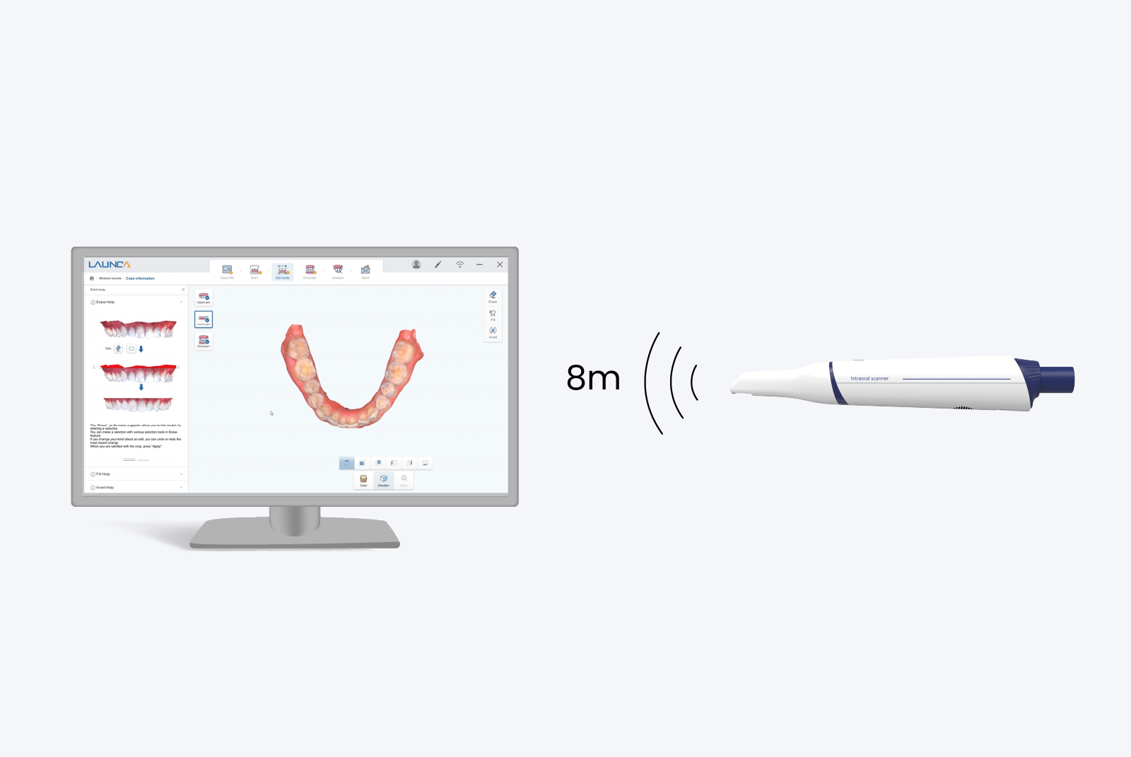 launca dl300 wireless intraoral scanner 8m wireless range