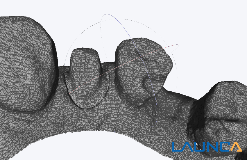 scan mash image by launca dl206 intraoral scanner